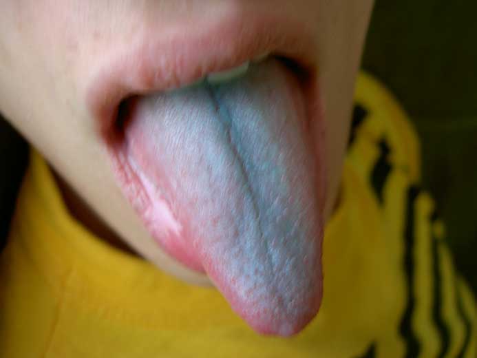 PICT0873